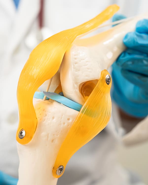 Orthopedic