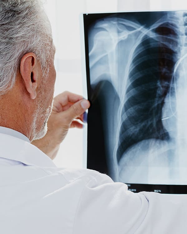 X-Ray Diagnostic